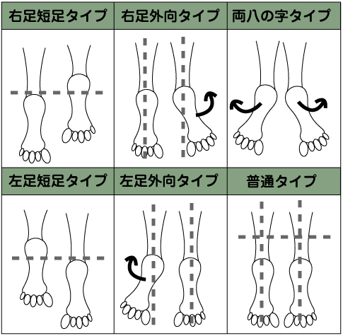 骨盤タイプ図解