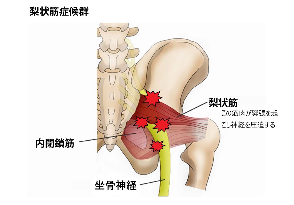 部位